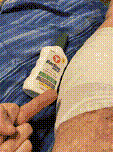 My leg, wrapped in gauze.